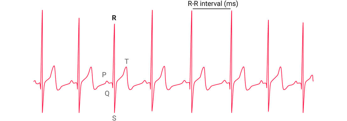 A graph showing a heart rate variability stress test.