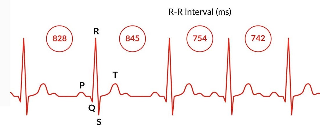 HRV Status